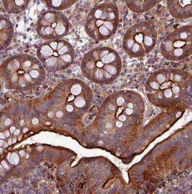 Immunohistochemistry-Paraffin: Papilin Antibody [NBP2-30550]