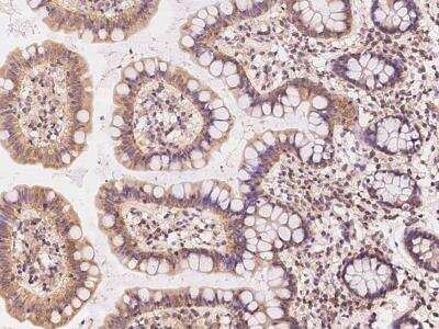 Immunohistochemistry-Paraffin: Papilin Antibody [NBP3-05954]