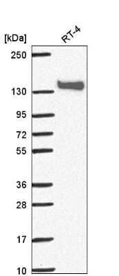 Western Blot: Papilin Antibody [NBP2-55338]