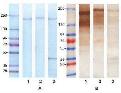 Western Blot: Pappalysin-1/PAPP-A Antibody (7A6) [NB100-73060]