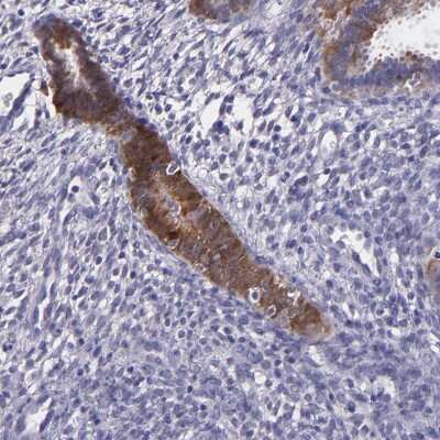 Immunohistochemistry-Paraffin: Pappalysin-1/PAPP-A Antibody [NBP1-90087]