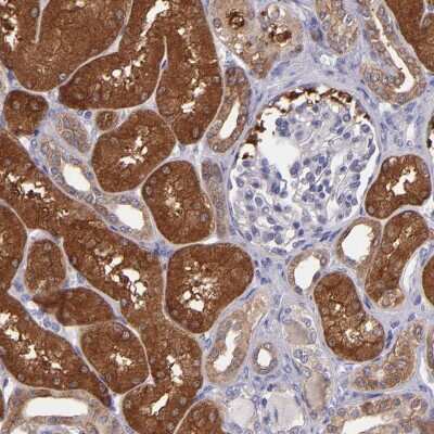 Immunohistochemistry-Paraffin: Pappalysin-1/PAPP-A Antibody [NBP1-90087]