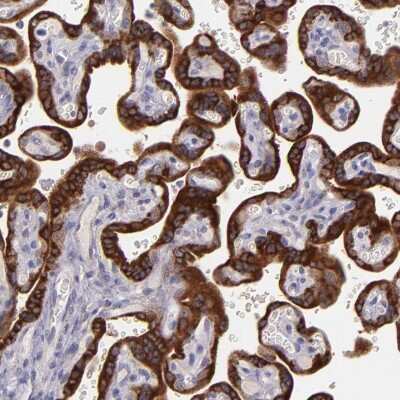Immunohistochemistry-Paraffin: Pappalysin-1/PAPP-A Antibody [NBP1-90087]