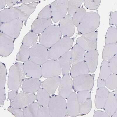 Immunohistochemistry-Paraffin: Pappalysin-1/PAPP-A Antibody [NBP1-90087]
