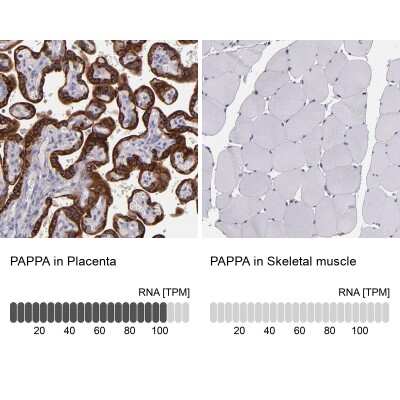 Immunohistochemistry-Paraffin: Pappalysin-1/PAPP-A Antibody [NBP1-90087]