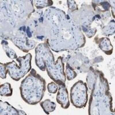 Immunohistochemistry-Paraffin: Pappalysin-1/PAPP-A Antibody (PAPP A 1-1) - BSA Free [NBP2-21614]