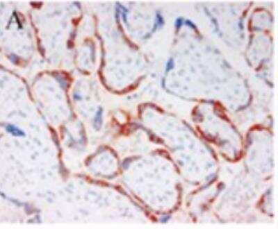 Immunohistochemistry-Paraffin: Pappalysin-1/PAPP-A Antibody (PAPP A 1-1) - BSA Free [NBP2-21614]