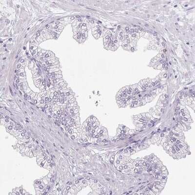 Immunohistochemistry-Paraffin: Pappalysin-2/PAPP-A2 Antibody [NBP1-87339]