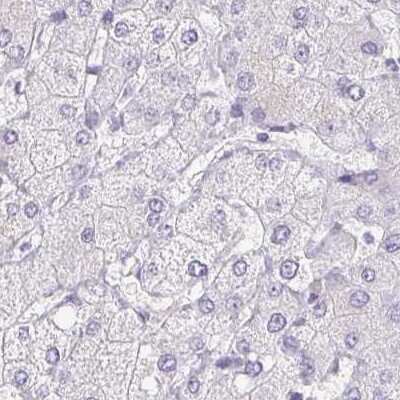 Immunohistochemistry-Paraffin: Pappalysin-2/PAPP-A2 Antibody [NBP1-87339]