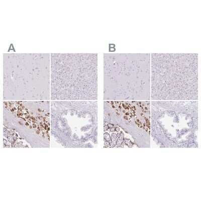 Immunohistochemistry-Paraffin: Pappalysin-2/PAPP-A2 Antibody [NBP1-87339]