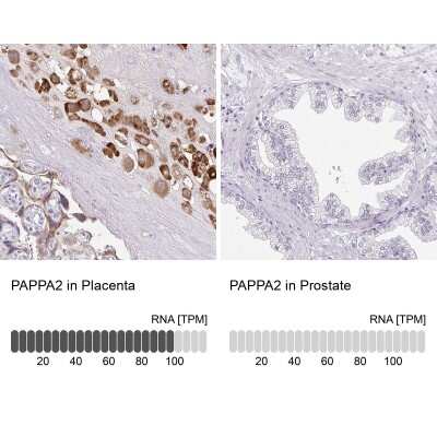 Immunohistochemistry-Paraffin: Pappalysin-2/PAPP-A2 Antibody [NBP1-87339]