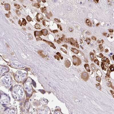 Immunohistochemistry-Paraffin: Pappalysin-2/PAPP-A2 Antibody [NBP1-87339]