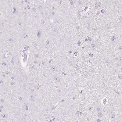 Immunohistochemistry-Paraffin: Pappalysin-2/PAPP-A2 Antibody [NBP1-87339]