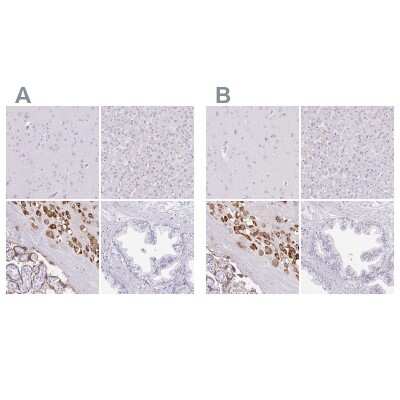 Immunohistochemistry-Paraffin: Pappalysin-2/PAPP-A2 Antibody [NBP1-87340]