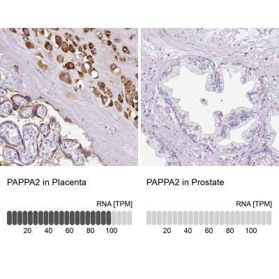 Immunohistochemistry-Paraffin: Pappalysin-2/PAPP-A2 Antibody [NBP1-87340]