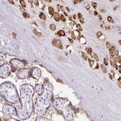 Immunohistochemistry-Paraffin: Pappalysin-2/PAPP-A2 Antibody [NBP1-87340]