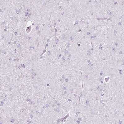 Immunohistochemistry-Paraffin: Pappalysin-2/PAPP-A2 Antibody [NBP1-87340]