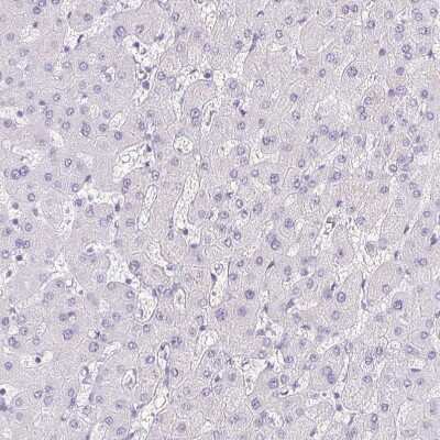 Immunohistochemistry-Paraffin: Pappalysin-2/PAPP-A2 Antibody [NBP1-87340]