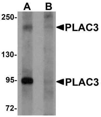 Western Blot: Pappalysin-2/PAPP-A2 AntibodyBSA Free [NBP1-76487]