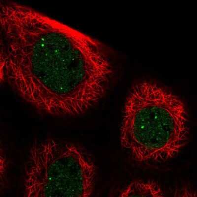 Immunocytochemistry/ Immunofluorescence: Paralemmin 3 Antibody [NBP2-30529]