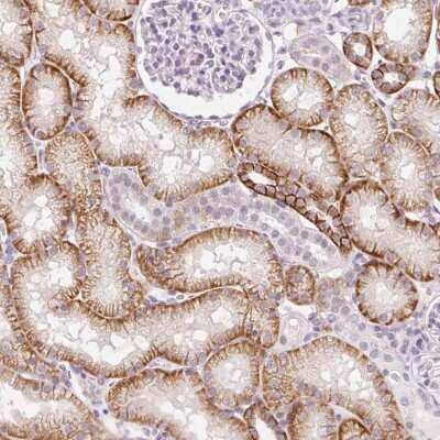 Immunohistochemistry-Paraffin: Paralemmin 3 Antibody [NBP2-30529]