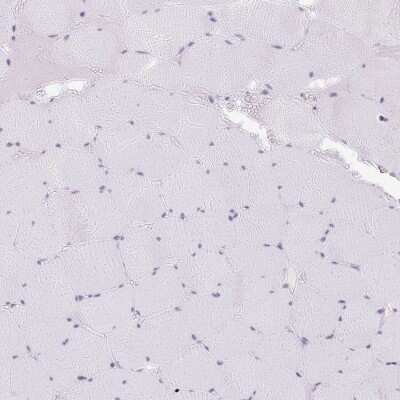 Immunohistochemistry-Paraffin: Paralemmin 3 Antibody [NBP2-30529]