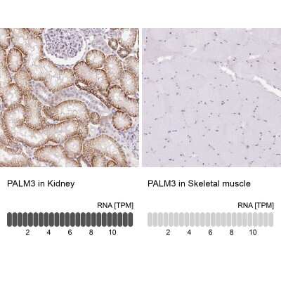 Immunohistochemistry-Paraffin: Paralemmin 3 Antibody [NBP2-30529]
