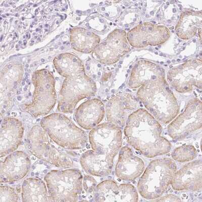 Immunohistochemistry-Paraffin: Paralemmin 3 Antibody [NBP2-30739]