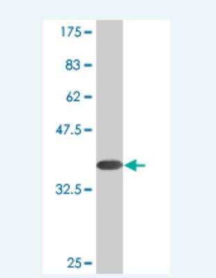 Western Blot: Paralemmin Antibody (4E1) [H00005064-M06]