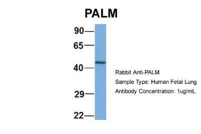 Western Blot: Paralemmin Antibody [NBP1-79624]