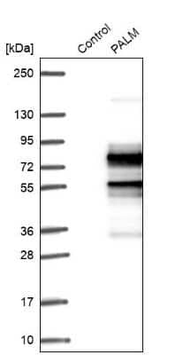 Western Blot: Paralemmin Antibody [NBP1-87770]