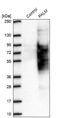 Western Blot: Paralemmin Antibody [NBP2-48940]