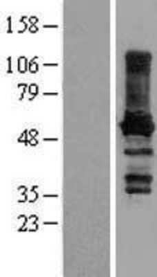 Western Blot: Paralemmin Overexpression Lysate [NBL1-14087]