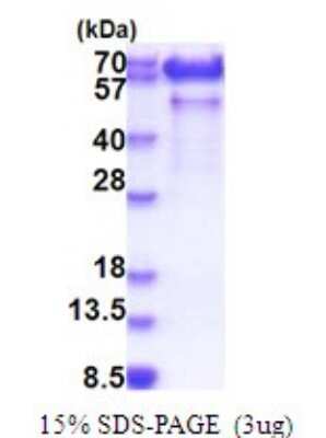 SDS-PAGE: Recombinant Human Paralemmin His Protein [NBP2-51782]