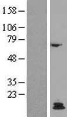 Western Blot: PTH Overexpression Lysate [NBP2-11146]