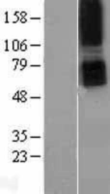 Western Blot: PTH1R/PTHR1 Overexpression Lysate [NBL1-14950]