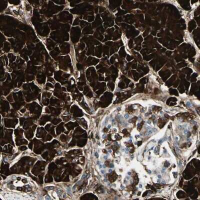 Immunohistochemistry: PTH2R Antibody [NBP2-34199]