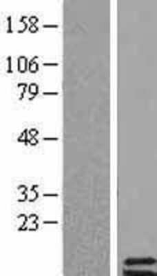 Western Blot: Parathyroid hormone 2 Overexpression Lysate [NBL1-14946]