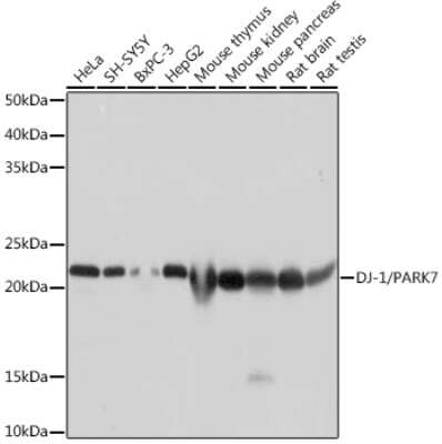 Western Blot: Park7/DJ-1 Antibody (1Q7F8) [NBP3-15663]