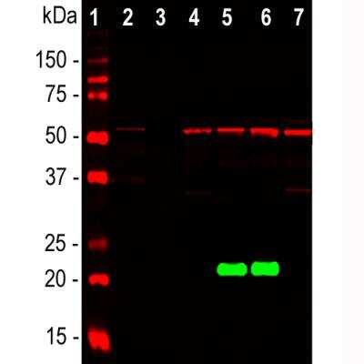 Western Blot: Park7/DJ-1 Antibody (4H4) [NBP1-92715]