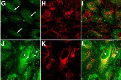 Immunocytochemistry/ Immunofluorescence: Park7/DJ-1 Antibody [NB300-270]