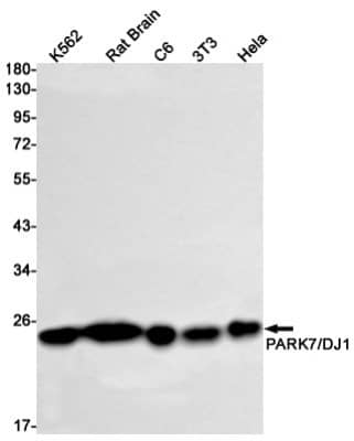 Western Blot: Park7/DJ-1 Antibody (S04-6H5) [NBP3-20087]