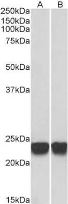 Western Blot: Park7/DJ-1 Antibody [NB100-1194]