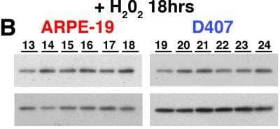Western Blot: Park7/DJ-1 Antibody [NB300-270]