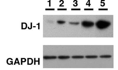 Western Blot: Park7/DJ-1 Antibody [NB300-270]
