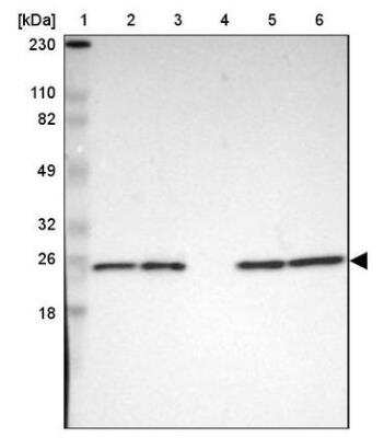 Western Blot: Park7/DJ-1 Antibody [NBP2-54654]