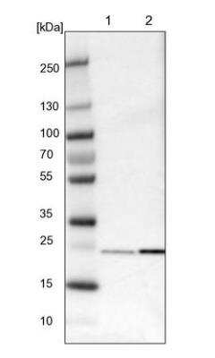 Western Blot: Park7/DJ-1 Antibody [NBP2-54654]