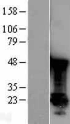 Western Blot: Park7/DJ-1 Overexpression Lysate [NBL1-14106]