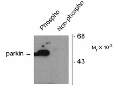 Western Blot: Parkin [p Ser101] Antibody [NB100-61106]