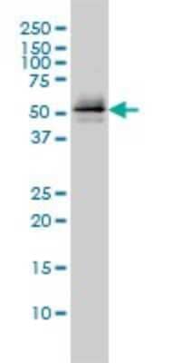 Western Blot: Parkin Antibody (1H4) [H00005071-M01]